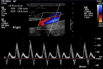 Üriner Sistem Doppler İncelemeler